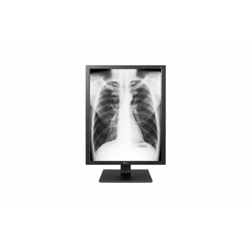 Диагностичен монитор 21.3 LG 21HK512D-B IPS 1000CD